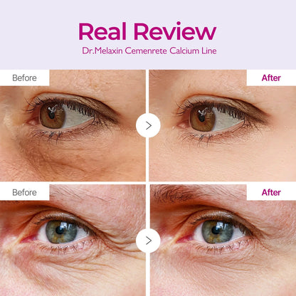 Cemenrete Calcium Multi Balm 9g